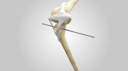 How to do a patella luxation surgery in cats and dogs with rapid luxation technique How to do a patella luxation surgery in cats and dogs with rapid luxation technique
