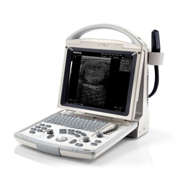 DP-30 Ultrasound System DP-30 Ultrasound System