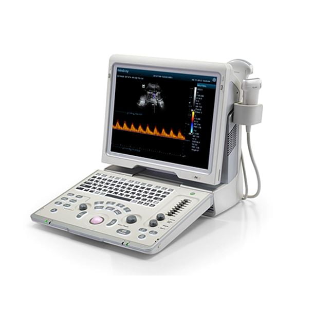 Z6 Ultrasound System Z6 Ultrasound System
